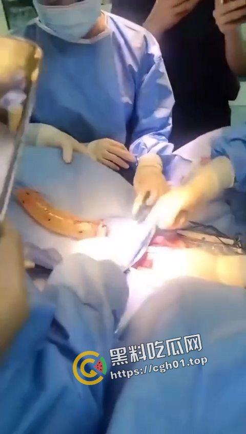 活久见！超大假阳具塞进体内拿不出来只能做手术 你们男同玩的都这么狠吗-1