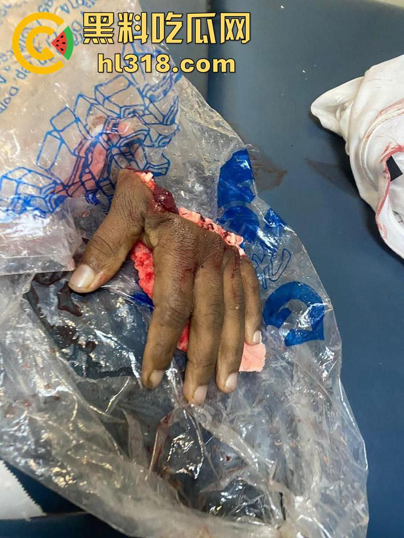 美国夜晚的恐怖，两拨黑哥发生冲突，老黑一刀将对方手掌切断，这刀是真快啊，这回估计要赔钱啦！-7