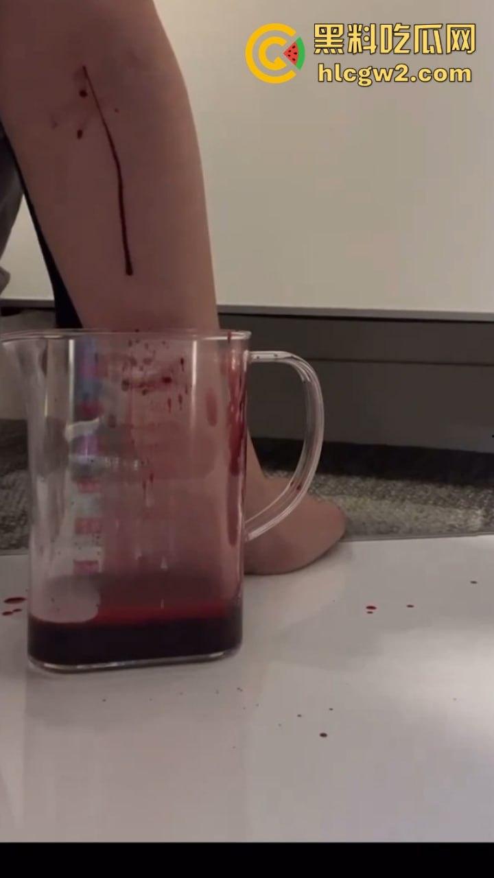 血腥慎入！推特十级脑残血腥自残自拍 残暴割腕引血自流 这是作死还是变态？-4